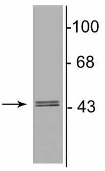 GABAA Receptor γ2 Antibody