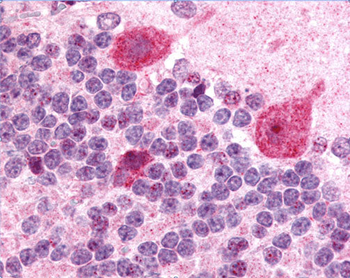 GABAA Receptor γ2 Antibody
