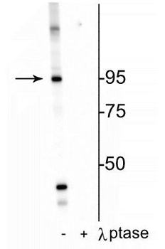 Insulin Receptor (Thr1160) Antibody
