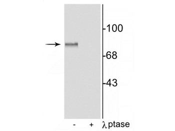MARCKS (Ser152,156) Antibody