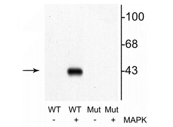 MEK1 (Thr292) Antibody