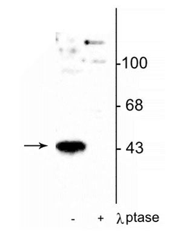 MEK1 (Thr386) Antibody