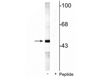 MEK5 (Ser311, Thr315) Antibody