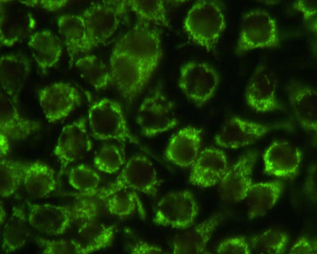 Mitochondria Antibody