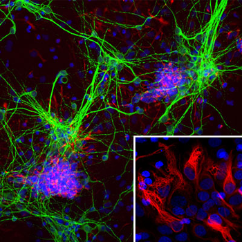 Nestin Antibody