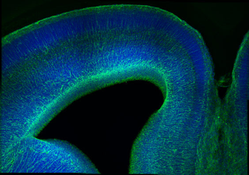 Nestin Antibody