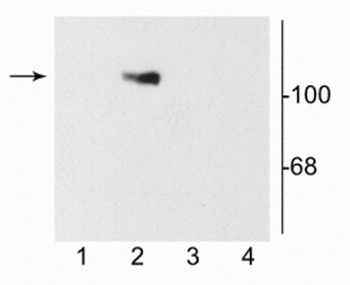 NMDA NR1 Subunit, Splice Variant C2 Antibody