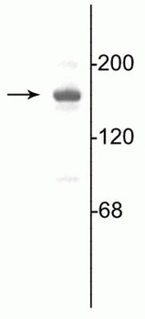 NMDA NR2A Subunit (100 ul) Antibody