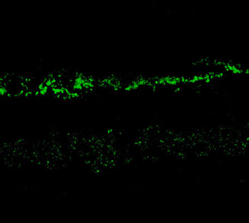 NMDA NR2A Subunit Antibody