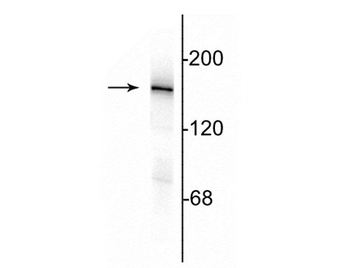 NMDA NR2A Subunit Antibody