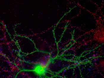 NMDA NR2A Subunit, N-terminus Antibody