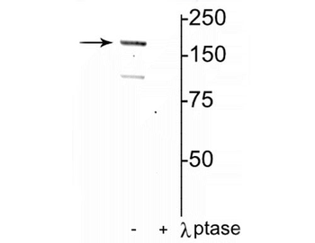 NMDA NR2A Subunit (Tyr1325) Antibody