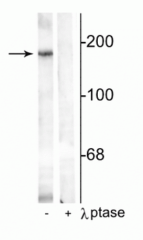 NMDA NR2B Subunit (Tyr1336) Antibody