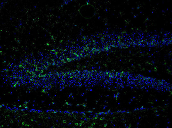 NMDA NR2B Subunit (Tyr1336) Antibody