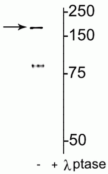 NMDA NR2B Subunit (Tyr1472) Antibody