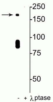 NMDA NR2B Subunit (Ser1480) Antibody