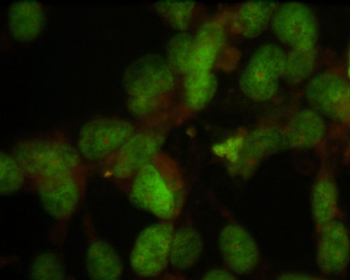 Nuclei Antibody