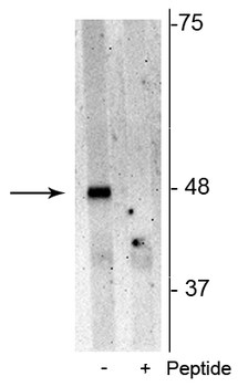 p62 (Ser28) Antibody