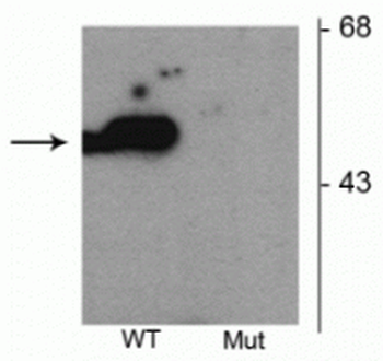 Parkin (Ser101) Antibody