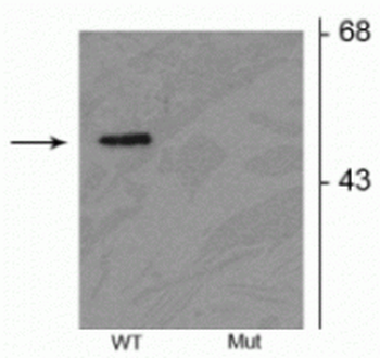 Parkin (Ser378) Antibody