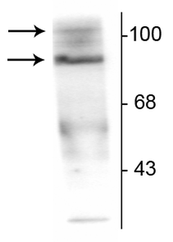 Progesterone Receptor (Ser190) Antibody