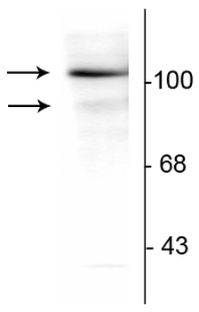 Progesterone Receptor (Ser294) Antibody