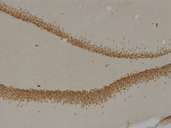 Prox1 Antibody