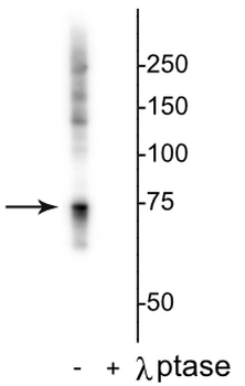 Raf-1 (Ser642) Antibody