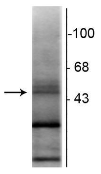 Retinoic Acid Receptor, ß-Isotype Antibody