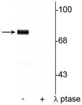 Synapsin I (Ser9) Antibody