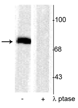 Synapsin I (Ser603) Antibody