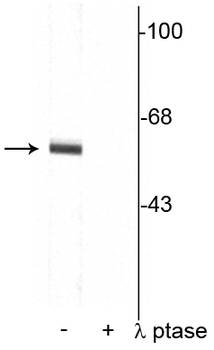Synaptotagmin (Thr202) Antibody