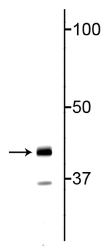TDP43 Antibody