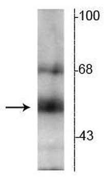 Thyroid Hormone Receptor, ß-Isotype Antibody