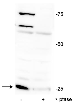 Troponin I (cardiac) Ser150 Antibody