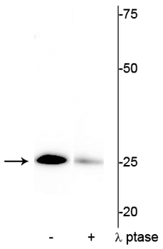 Troponin I (cardiac) Ser43 Antibody