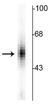 Tryptophan Hydroxylase Antibody