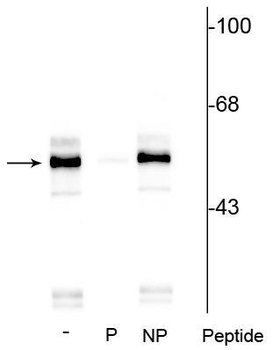 Tryptophan Hydroxylase (Ser260) Antibody