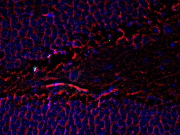 Tubulin, beta III Antibody