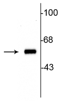 Tyrosine Hydroxylase Antibody