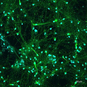 Tyrosine Hydroxylase Antibody