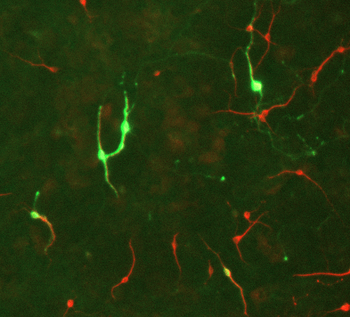 Tyrosine Hydroxylase Antibody