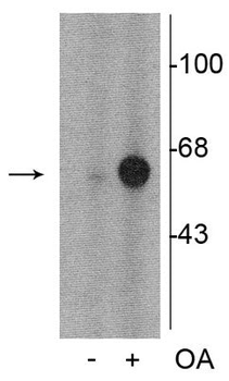 Tyrosine Hydroxylase (Ser31) Antibody