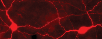 Tyrosine Hydroxylase (Ser40) Antibody