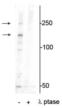 Xin Actin-binding Repeat-containing Protein 1 (XIRP1) (Ser295) Antibody