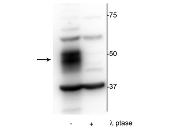 MEF2C (Ser222) Antibody