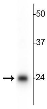 TFAM (Transcription Factor A, motochondrial) Antibody