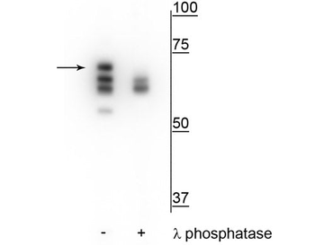 Hsp70 (Ser153) Antibody