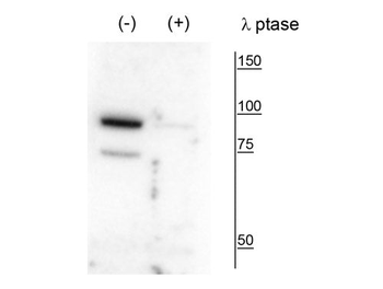 PanK4 (Thr63) Antibody