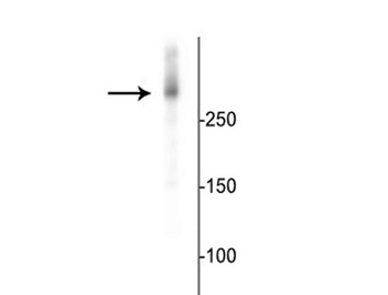 Microtubule Associated Protein 2 (MAP2) Antibody